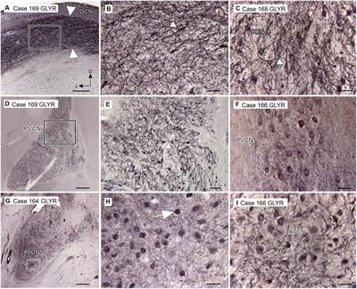 Glycine is a transmitter in the human and chimpanzee cochlear nuclei